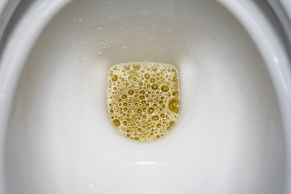 Kencing Berbusa pada Wanita, Normal atau Berbahaya?