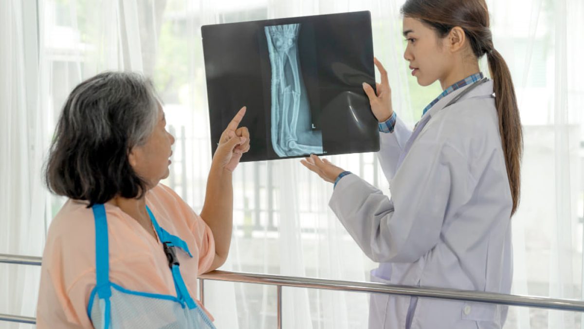 Cara Mengatasi Pengapuran Tulang Pada Lansia